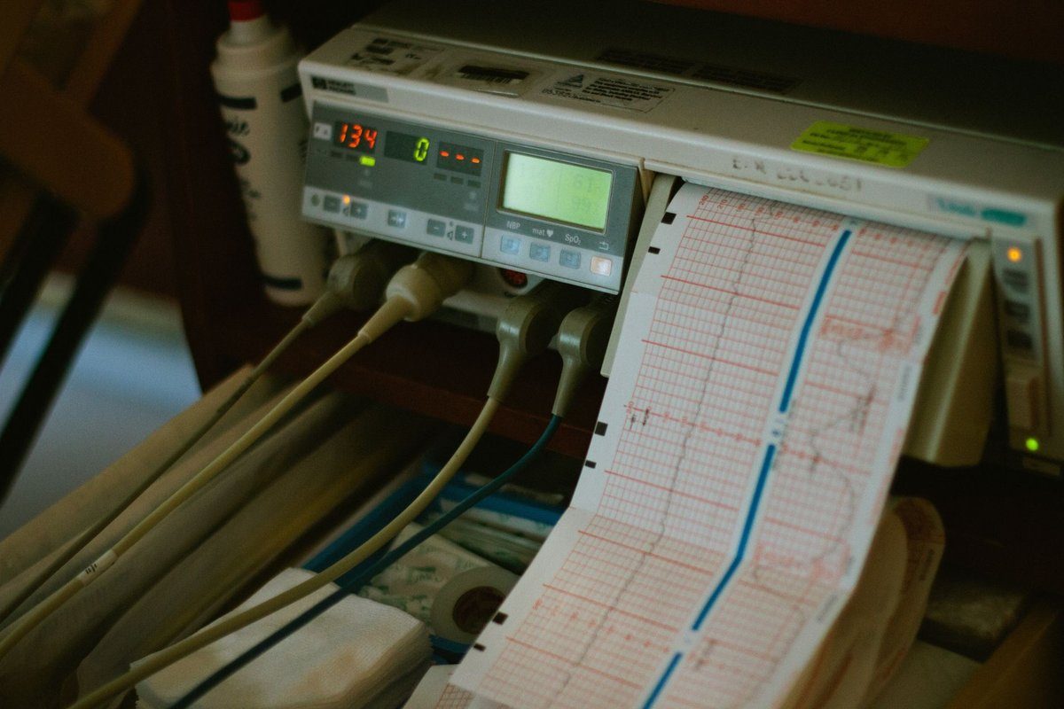 fréquence cardiaque maximale